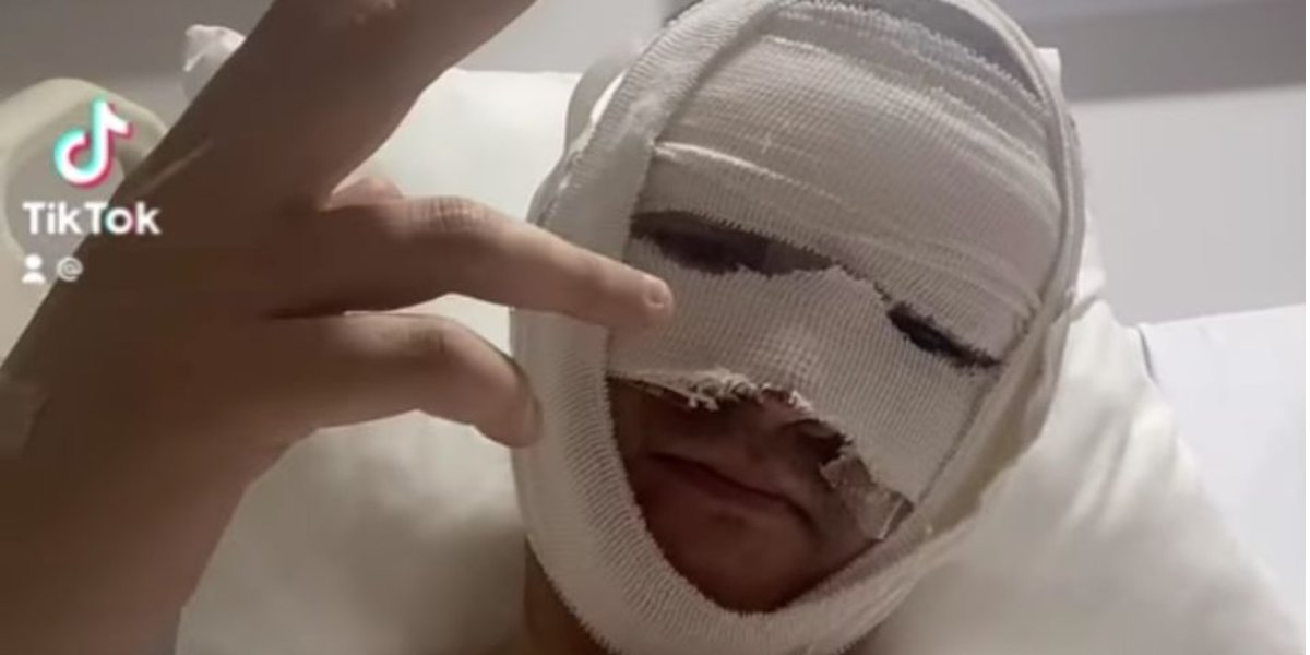 Actor de Televisa se quema la cara y termina en el hospital; temen por su carrera