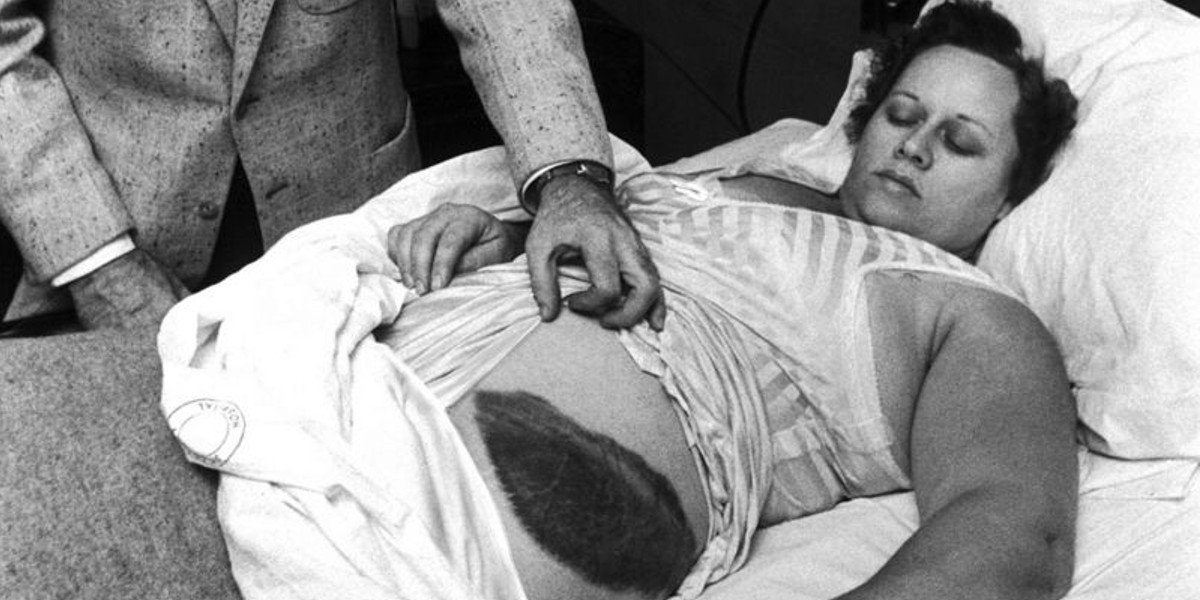 Ella es la única persona a la que le ha caído encima un meteorito