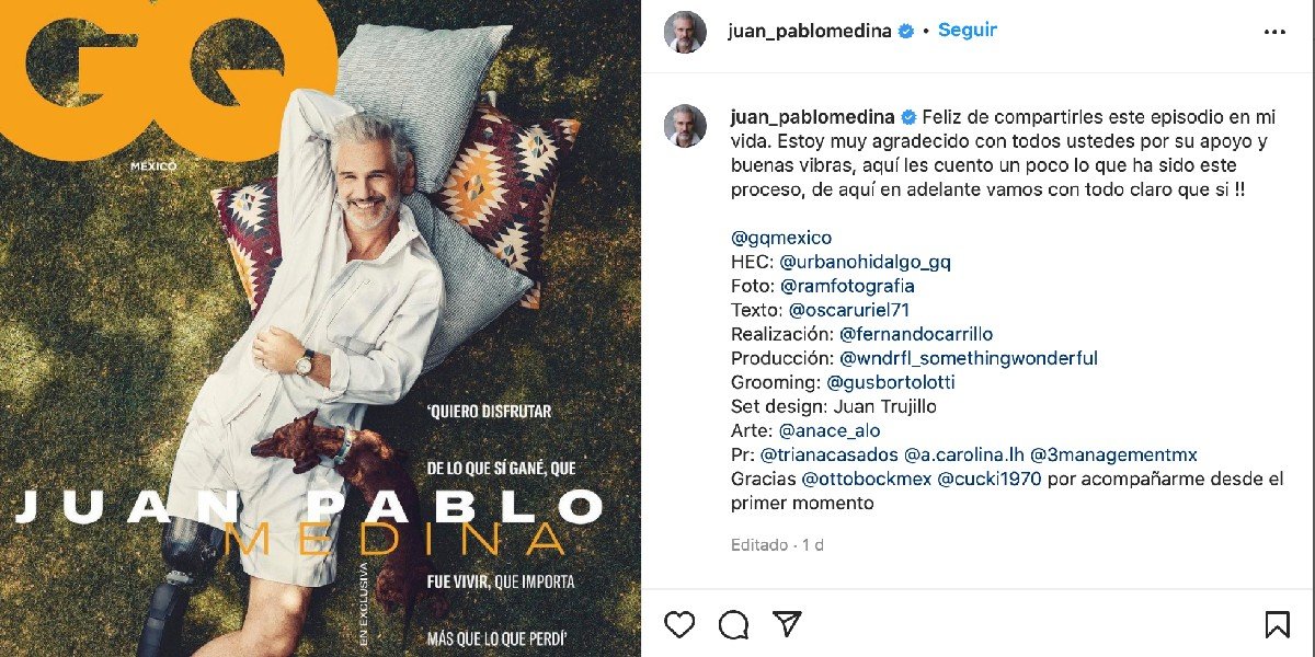 Juan Pablo Medina: Así reaccionaron los famosos a su reaparición en portada de revista con prótesis